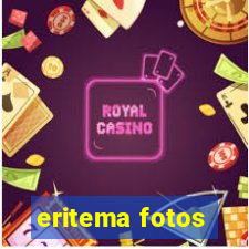 eritema fotos